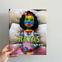 UN CASO GRAVE DE RAYAS. PASTA BLANDA